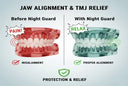 Can Night Guards Help with Jaw Alignment?