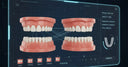 3D digital model used to create custom clear aligners