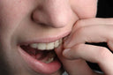 Is Your Retainer Fitting Right? 5 Signs