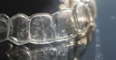 Sharp Foods & Aligners: Hidden Scratching Risks
