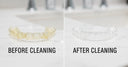 How to Clean Your Aligners Using an Electric Toothbrush: A Step-by-Step Guide