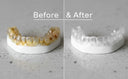 Tips for Keeping Your Clear Aligners Clean and Stain-Free