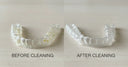 Cleaning Aligners with an Electric Toothbrush: Best Practices for a Fresh Smile