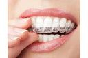 What Is a Clear Retainer & Why You Need One