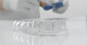 A Guide to Fitting and Adjusting Your Nighttime Aligners
