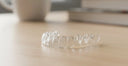 The Long-Term Comfort Comparison: Fixed vs Removable Retainers