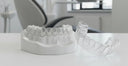 At-Home Aligner Journey: Step by Step