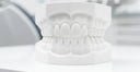 The Importance of Accurate Impressions for Effective Retainers