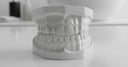 Clear teeth retainer on dental model showing how retainers maintain tooth alignment