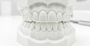How Impressions for Retainers Impact Your Orthodontic Treatment