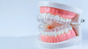 Clear retainers used for crossbite correction