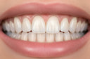 Quick Invisalign vs Traditional Invisalign Compared