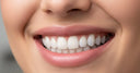 Close-up of a person smiling, showing white, perfectly aligned dental veneers