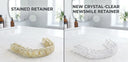 NewSmile Clear Retainers vs ClearCorrect Clear Retainers: Retainers That Last