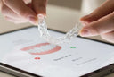 NewSmile at-home aligners monitored digitally for effective treatment.