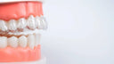 Unlocking Smiles: What Are Aligners and How They Transform Your Grin