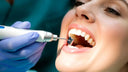 Dental hygienist performing scaling with ultrasonic scaler on patient