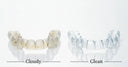 Say Goodbye to Bacteria: How to Clean Aligners with an Electric Toothbrush