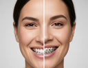Ultra-realistic split-screen image comparing clear aligners vs traditional metal braces.