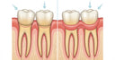 Gum tissue improvement after surgery