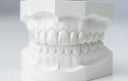 custom night guard fitted on a dental model close-up.