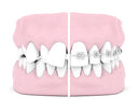 Overjet Correction: Can Retainers Help?