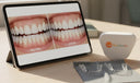Online Orthodontist for Minor Teeth Issues