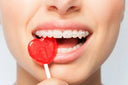 The Lollipop Dilemma: Can You Eat Lollipops with Braces?