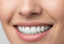 Essix Retainers: Clear Retainers Explained