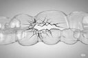 Should-I-Clean-Aligners-with-Toothpaste NewSmile™ USA