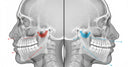 Before-and-after jaw alignment following orthognathic surgery