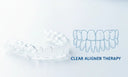 Close-up of clear aligners next to a subtle gap between teeth illustration