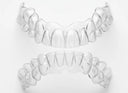 Why Clear Aligners Are the Ultimate Game-Changer for Your Smile