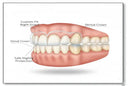 Night Guards & Dental Work: Compatibility Guide