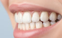 Healthy gums and retainer wear during hormonal changes