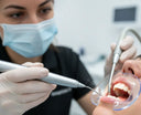 The Dental Scoop: What Is Cleaning?