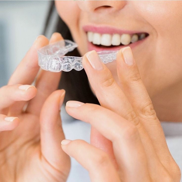 The Travel-Friendly Smile: How to Keep Your Teeth Aligned On-the-Go
