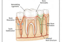 Diagram showing how retainers stabilize teeth and bone after treatment