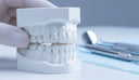 Clear aligner used to maintain post-orthodontic enamel health