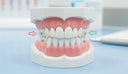 Dental model showing corrected posterior crossbite