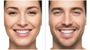 A split image showing two adult smiles side by side