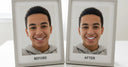 6-Month Smile Transformations You Have to See