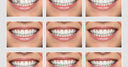 The Ultimate Guide: How Long Do Invisalign Take?