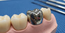 Stainless steel dental crown for kids' molars