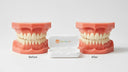 Orthodontic Retainers and Orthognathic Surgery: Their Relationship