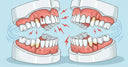 "Diagram illustrating sudden tooth movement while wearing a retainer"