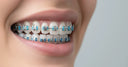 Achieving the Perfect Smile: A Guide to Modern Dental Solutions