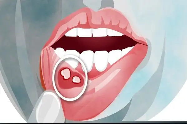 Why Are My Braces Cutting My Lips?