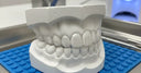 What Are Dental Night Guards and How Do They Work?