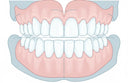 Retainers supporting jaw alignment and bite balance